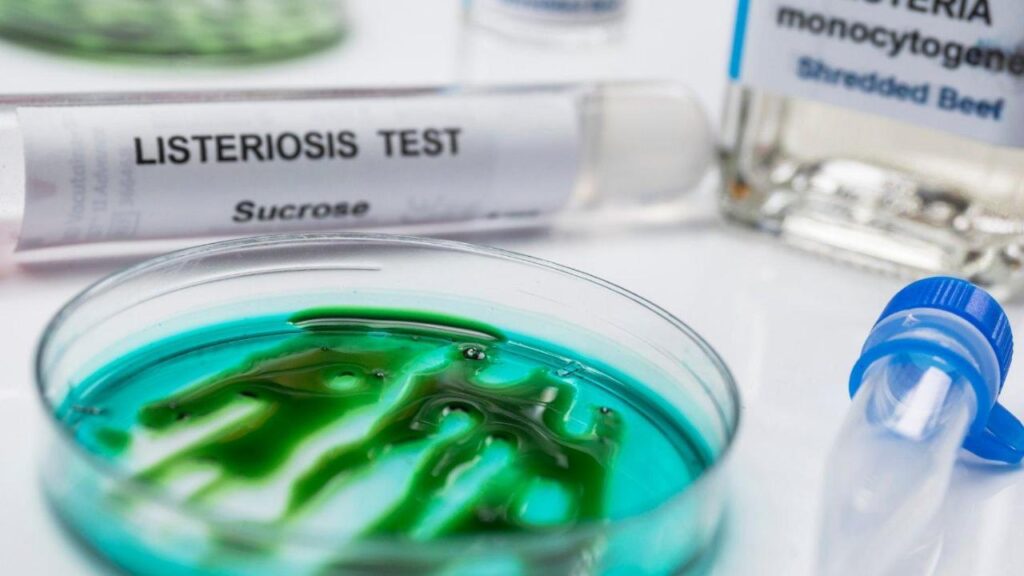 Gene-up Typer : la solution de typage rapide pour identifier l’origine des contaminations à Listeria monocytogenes