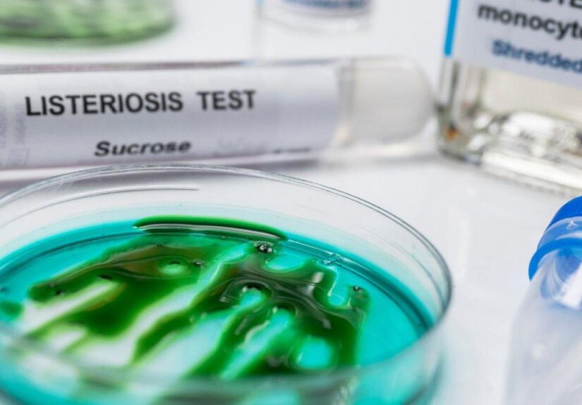 Gene-up Typer : la solution de typage rapide pour identifier l’origine des contaminations à Listeria monocytogenes